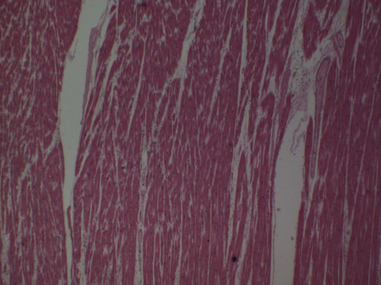 cardiac muscle1